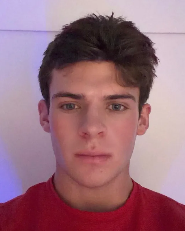 Gunner’s face transformation after
