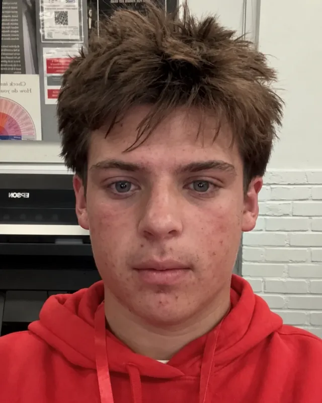 Gunner’s face transformation before